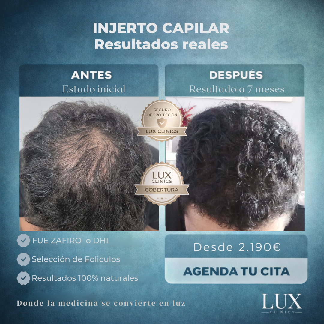 Lux Clinics Facebook ad