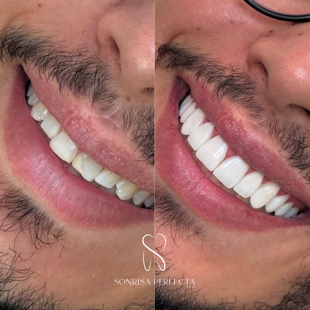 Sonrisa Perfecta Facebook ad