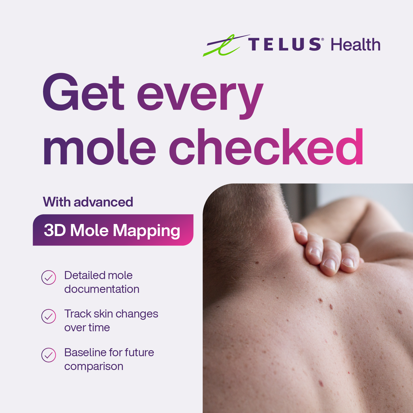TELUS Health Facebook ad: Book a Mole Mapping Scan