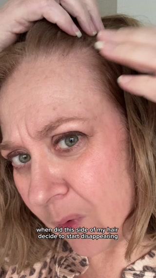Bloom & Bond Facebook ad: Help Hair Loss Naturally