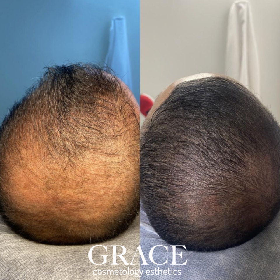 Grace Cosmetology Esthetics Facebook ad