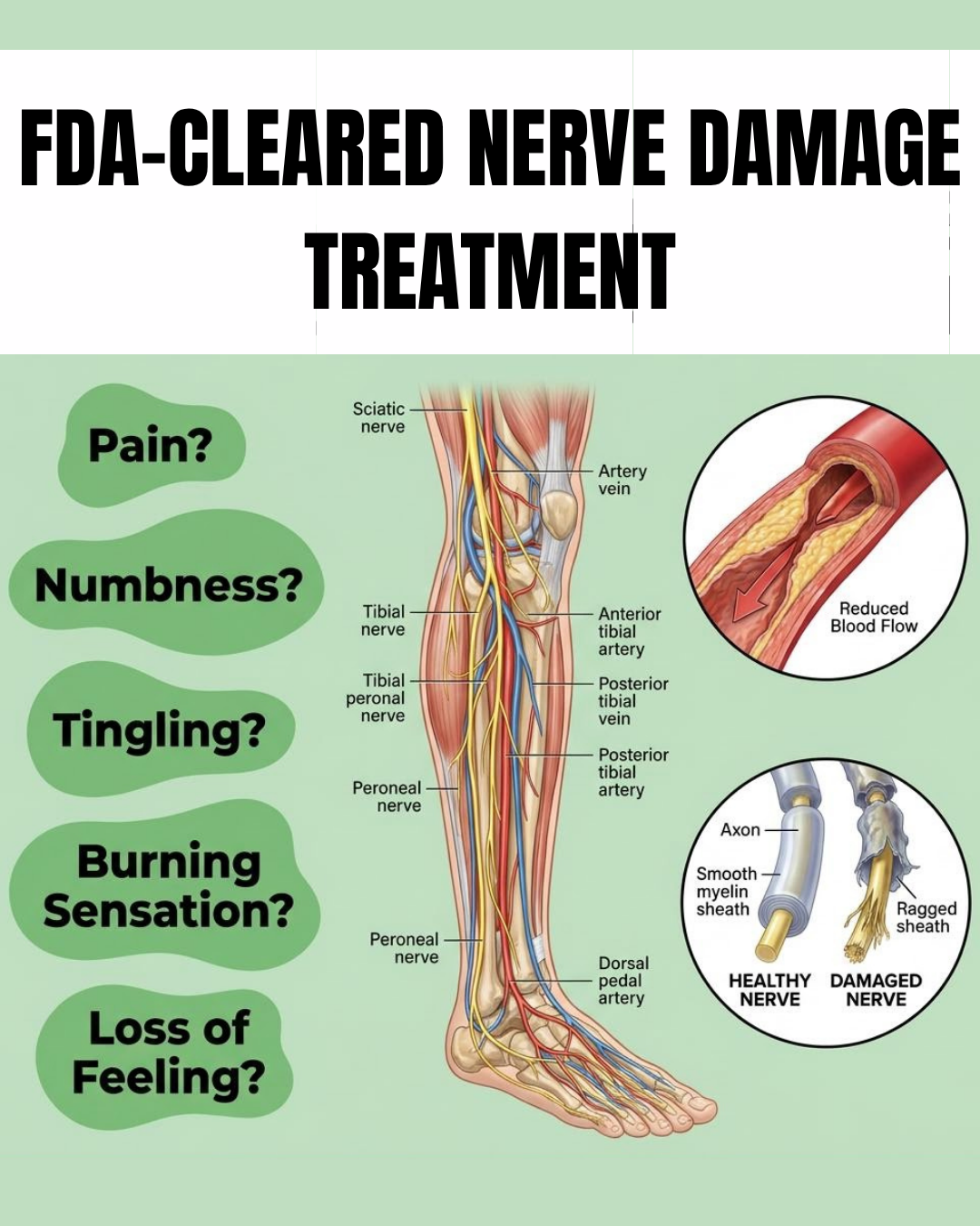 In Good Health LV Facebook ad: Neuropathy Pain Relief Assessment
