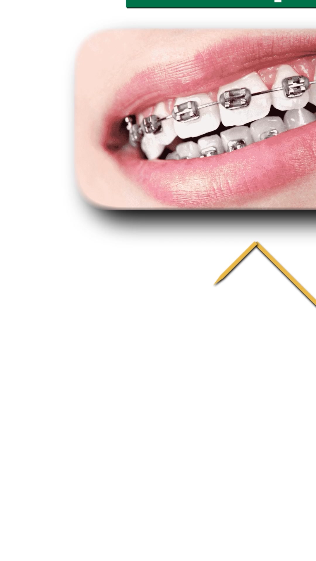 Real Dental Care ريـل لطب الاسنان Facebook ad: تقويم الاسنان بأنسب سعر وبالتقسيط المريح جداً
