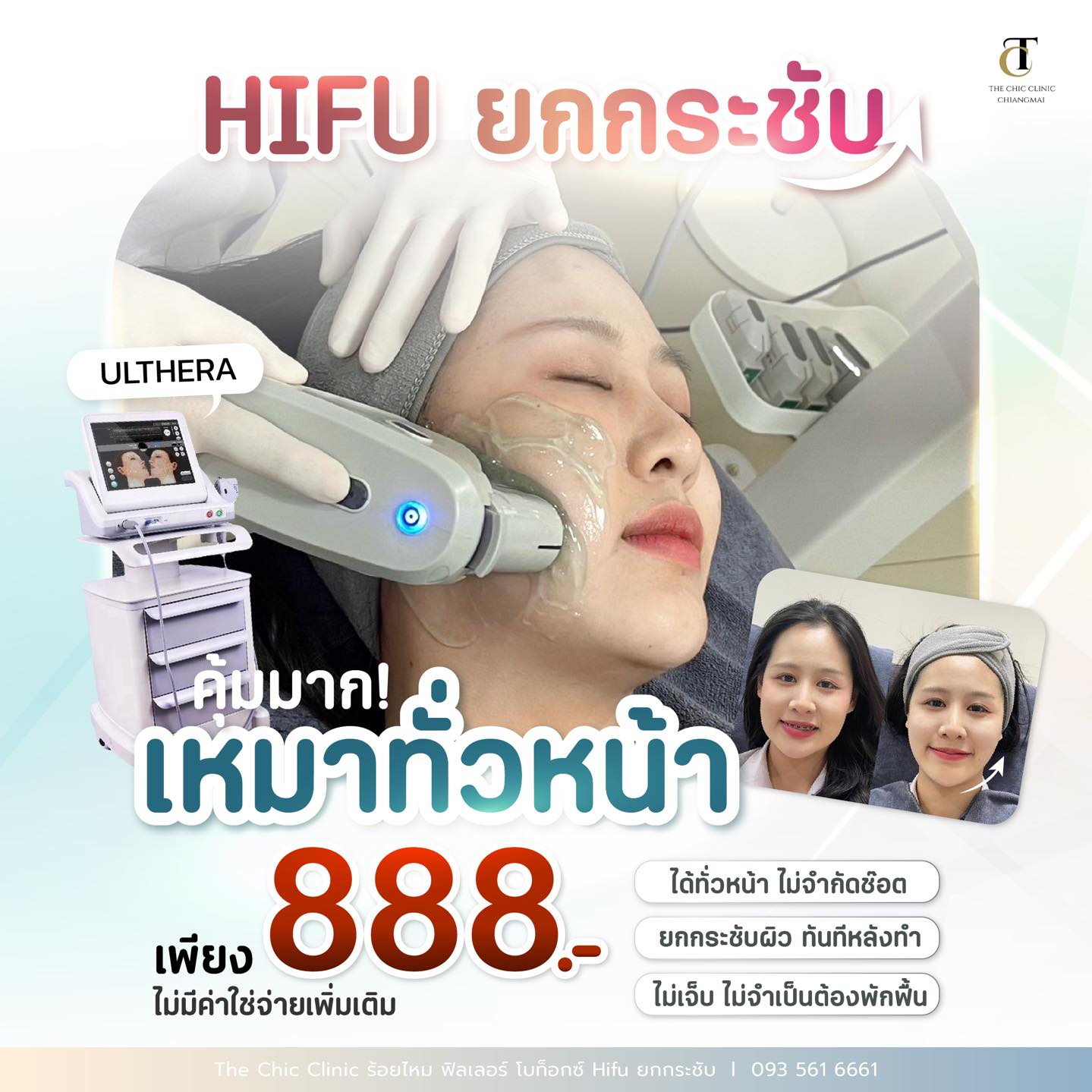 The Chic clinic ร้อยไหม ฟิลเลอร์ โบท็อกซ์ Hifu ยกกระชับ Facebook ad: กลับมาตามคำเรียกร้อง ยกกระชับขั้นสุด! 𝐇𝐢𝐟𝐮 𝐕 𝐥𝐢𝐟𝐭…