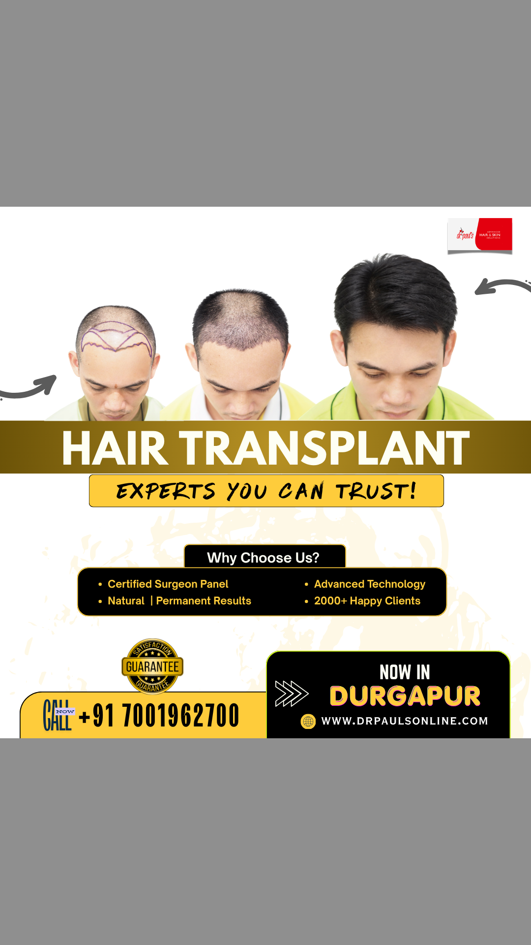 Dr. Paul's Advanced Hair & Skin Solutions, Durgapur Facebook ad from May 6, 2026
