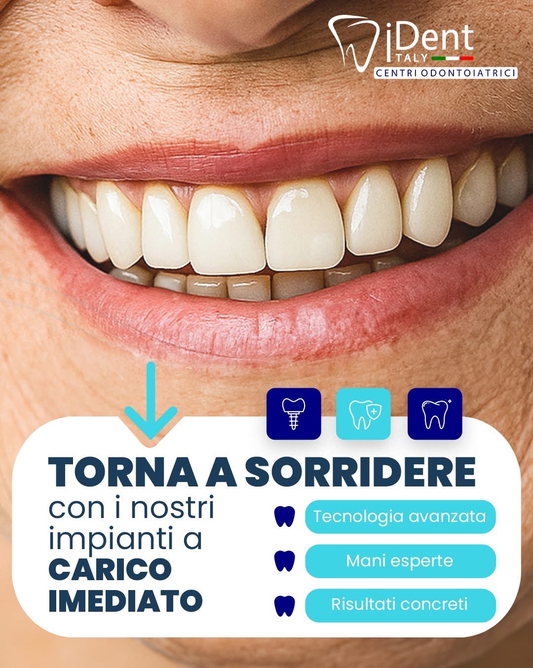 Italydent Facebook ad from Jun 8, 2026
