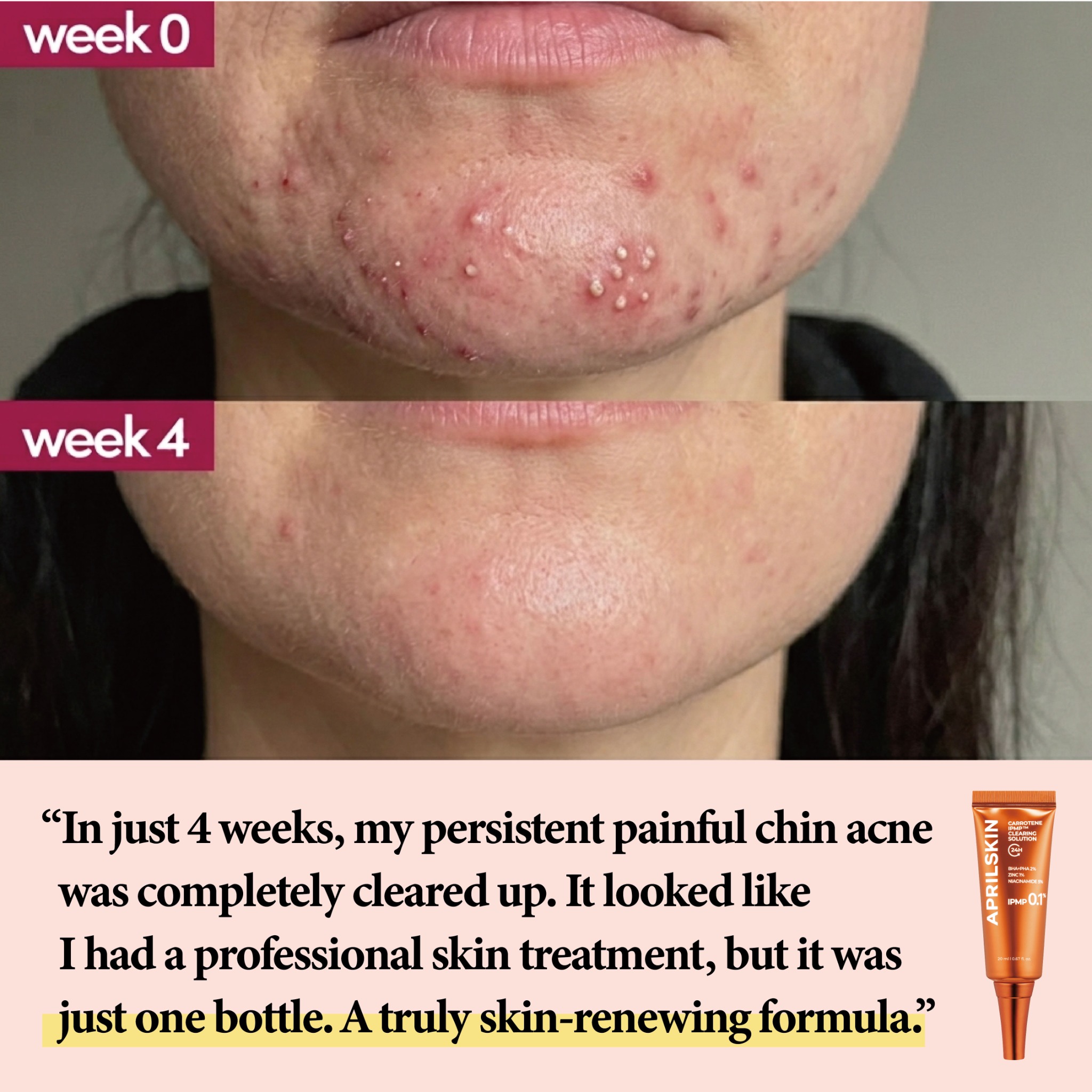 APRILSKIN Facebook ad