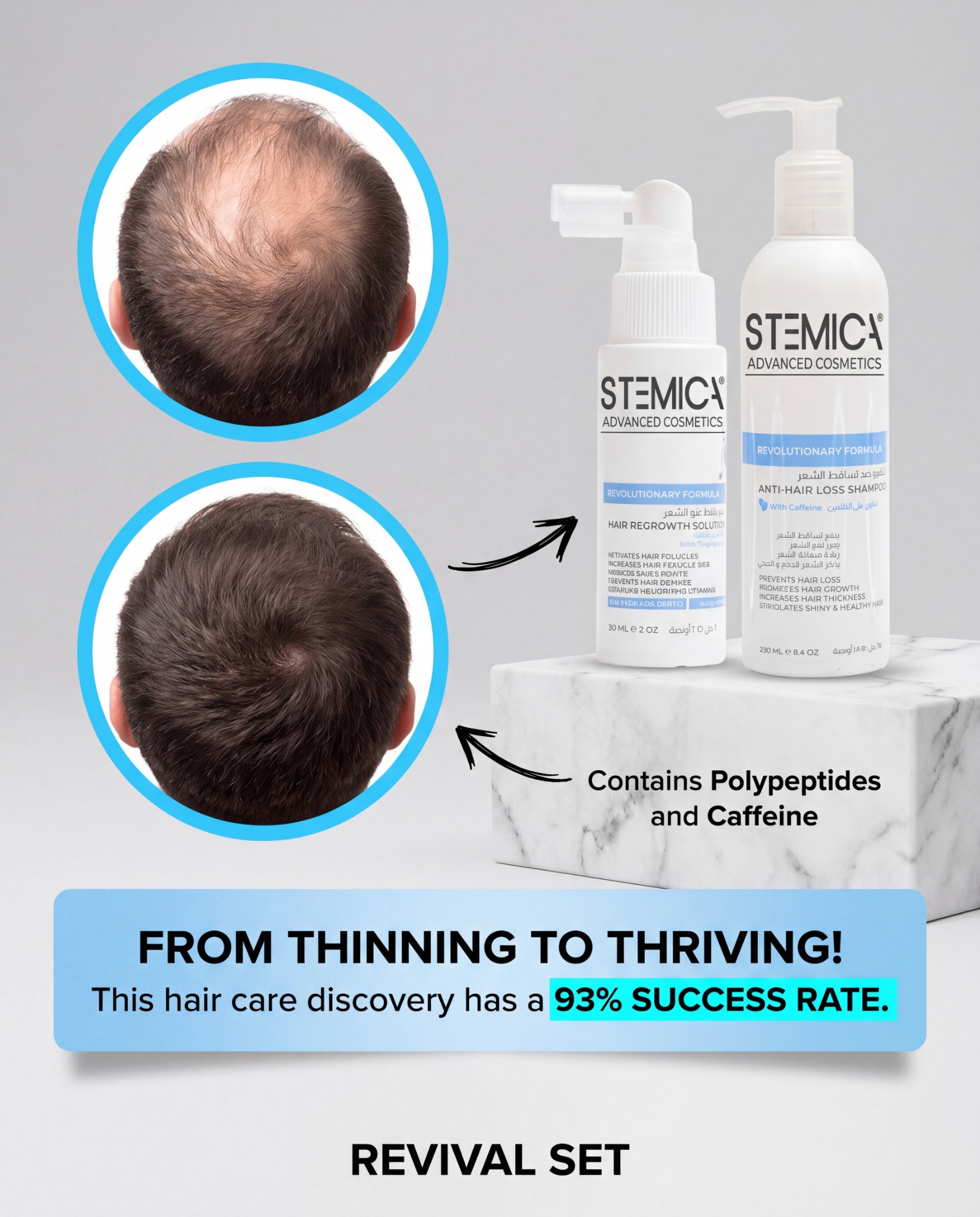 Stemica Facebook ad: Commit 90 Days to Fuller Hair