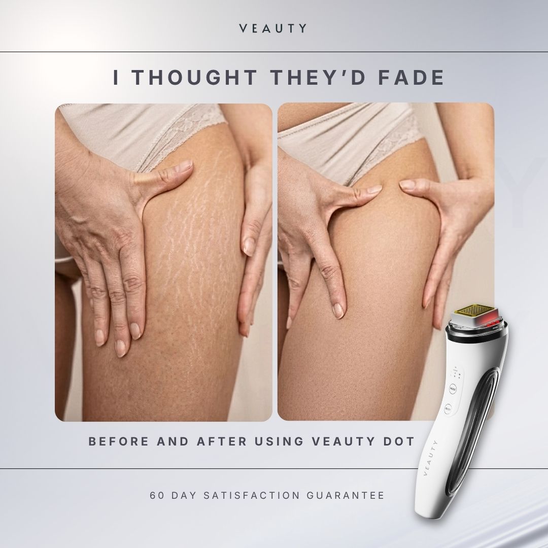 Veauty Facebook ad