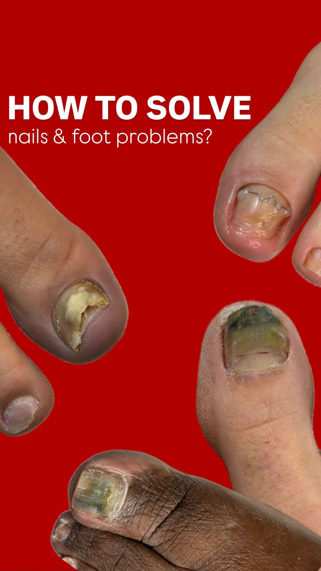 YOU.KA pro nails akademy Facebook ad: Do you want to learn how to solve…