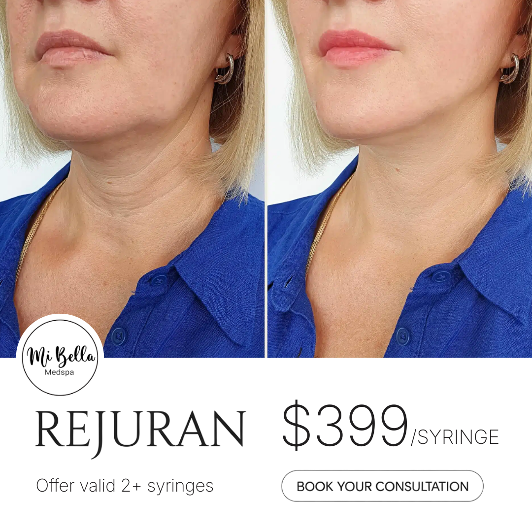 Mi Bella Med Spa Facebook ad