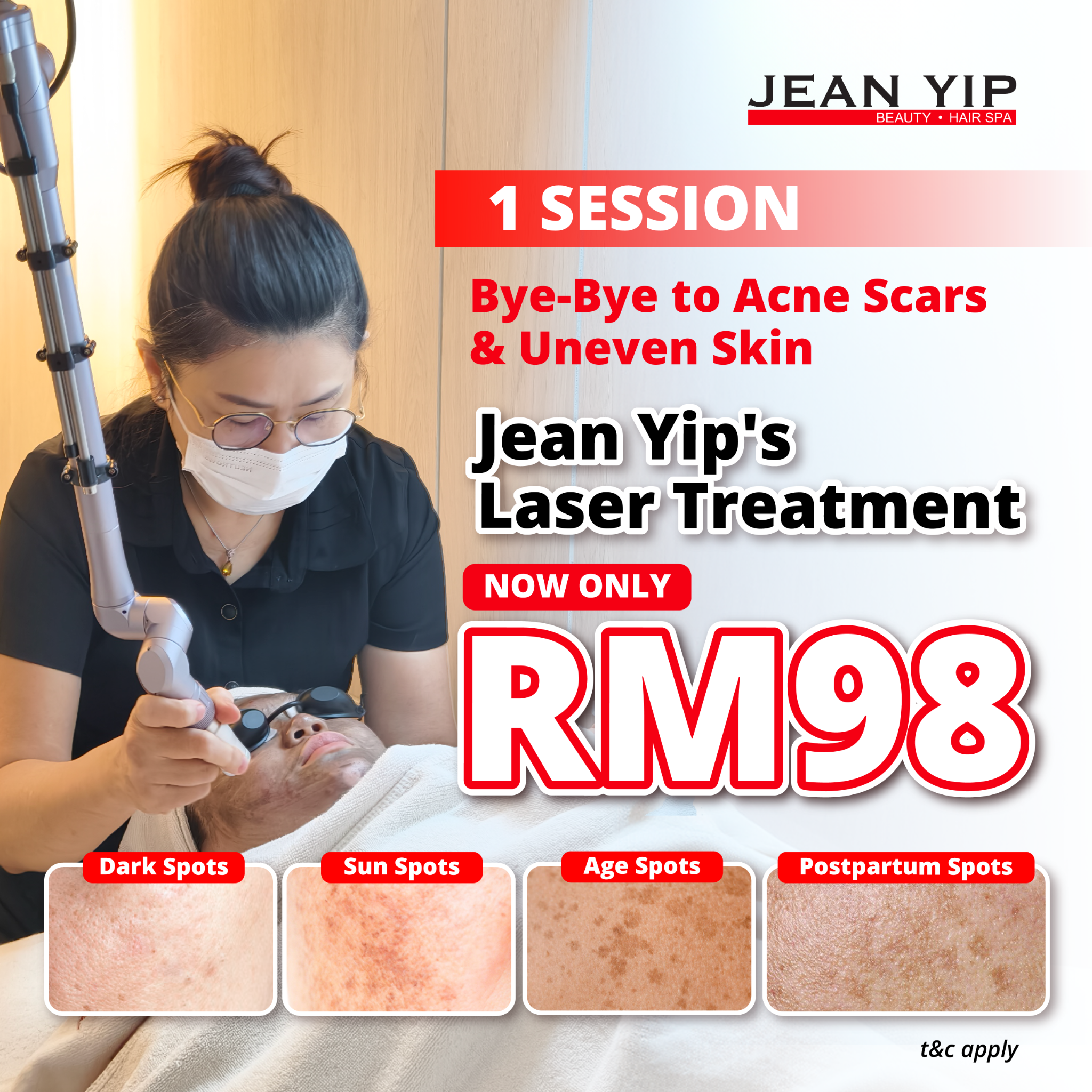 Jean Yip Malaysia Facebook ad: Laser Hyperpigmentation Treatment - Jean Yip Malaysia