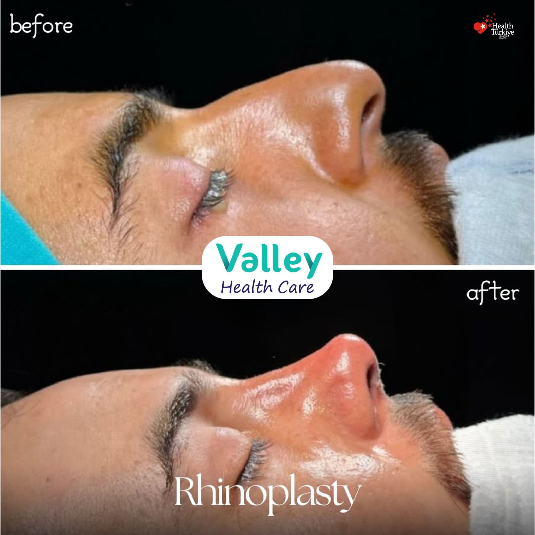 Valley Clinic Turkey Facebook ad