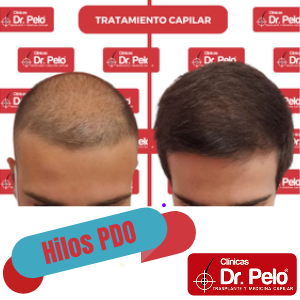 Clinicas Dr Pelo Facebook ad