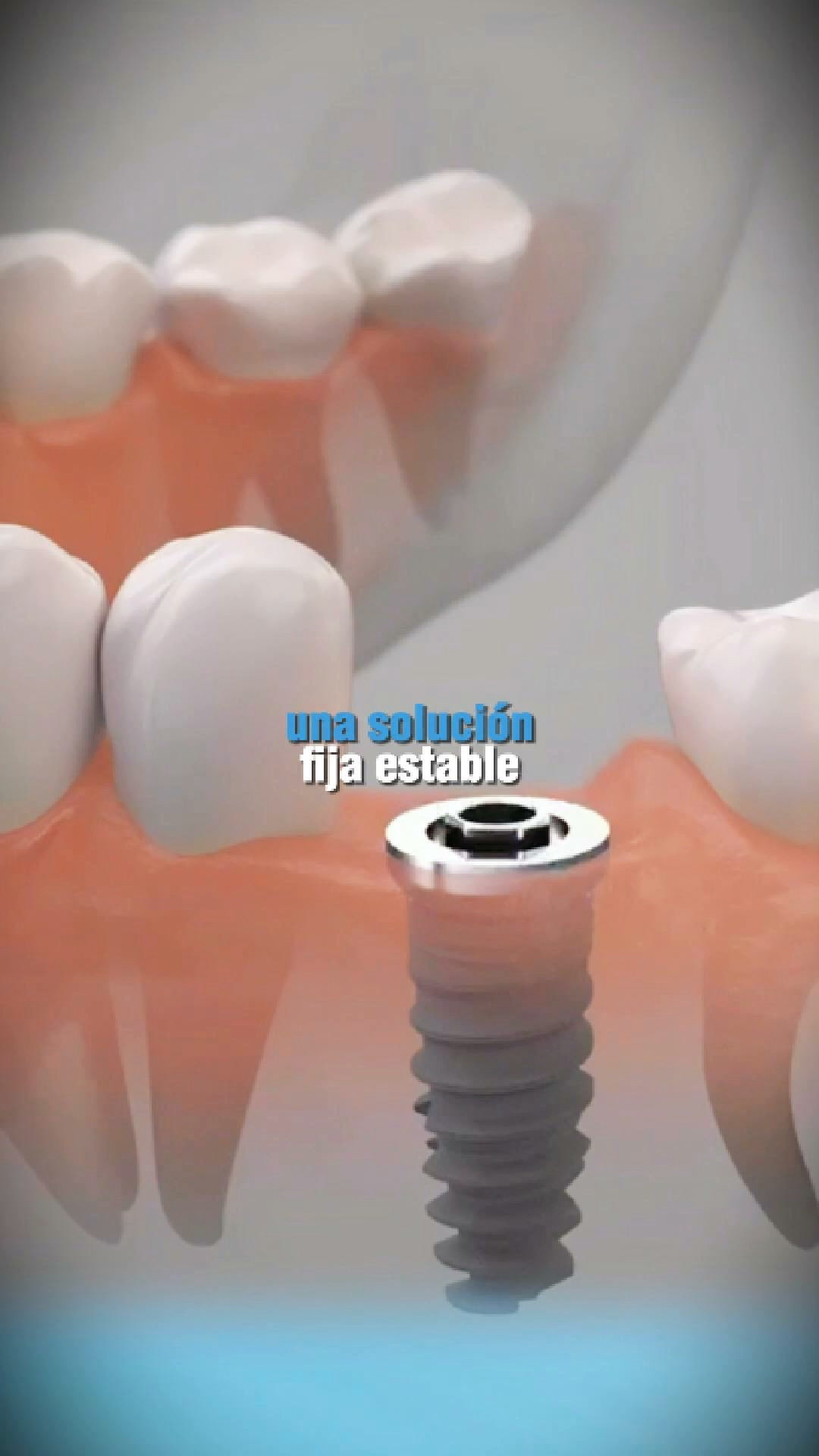 Padilla Clinica Dental Facebook ad from Jul 16, 2026