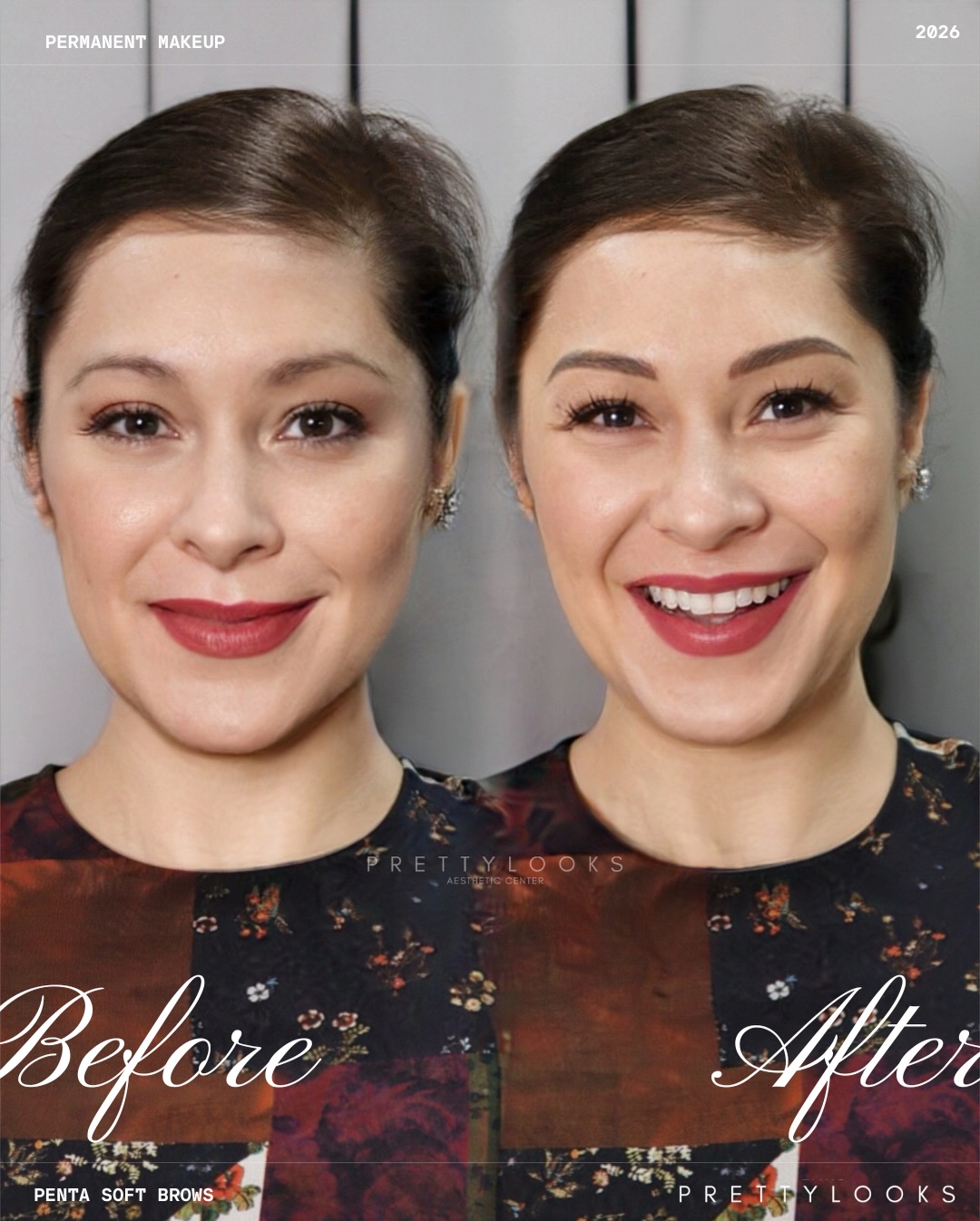 Prettylooks Facebook ad: Ms. Sheryl Cruz’s glow, elevated, softly defined, naturally…