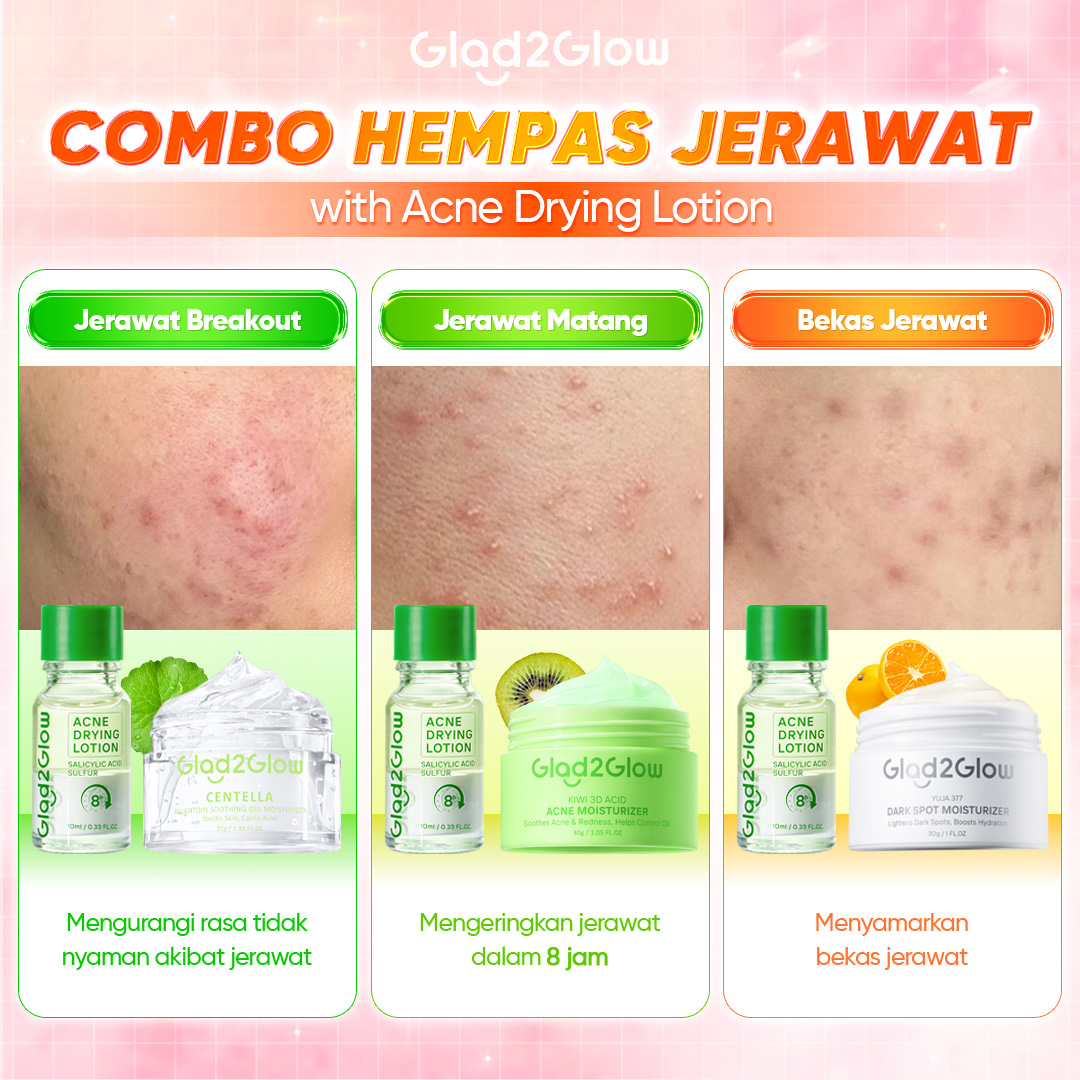Glad 2 Glow.indo Facebook ad
