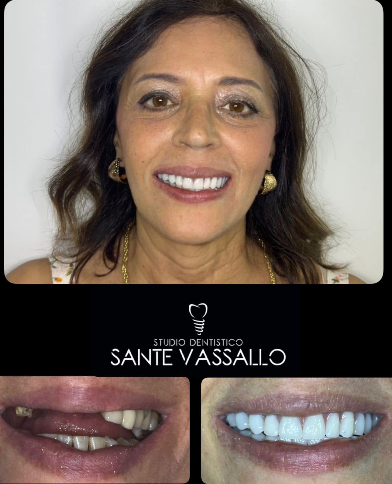 Dott. Sante Vassallo Odontoiatra Facebook ad: RITROVA IL SORRISO