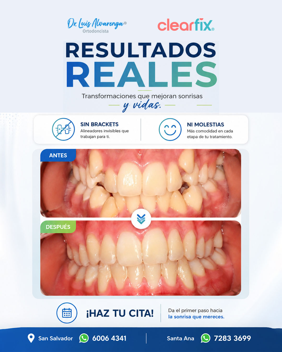 Dr.Luis Alvarenga.Ortodoncista Facebook ad: Una sonrisa puede cambiar más de lo que…