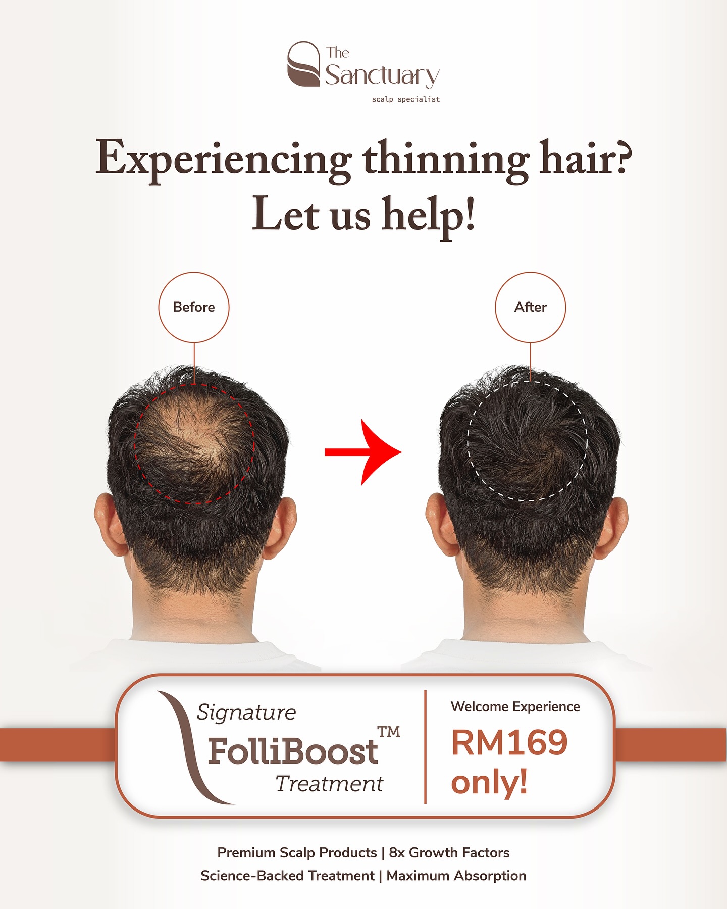 The Sanctuary Scalp Care Centre Facebook ad