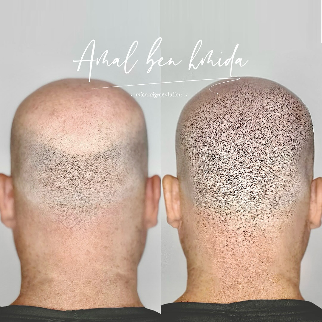 microblading_studio_abh Facebook ad: Private 1-to-1 Scalp Micropigmentation studio in Doha.