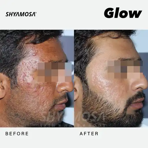 Shyamosa Facebook ad from Jan 19, 2026