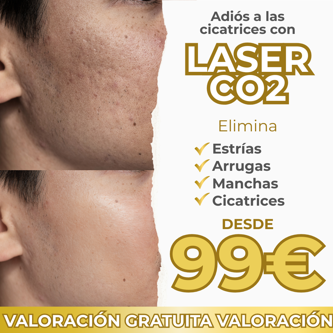 Clínica Esmera Facebook ad: Láser CO2 en Madrid desde solo 99 €