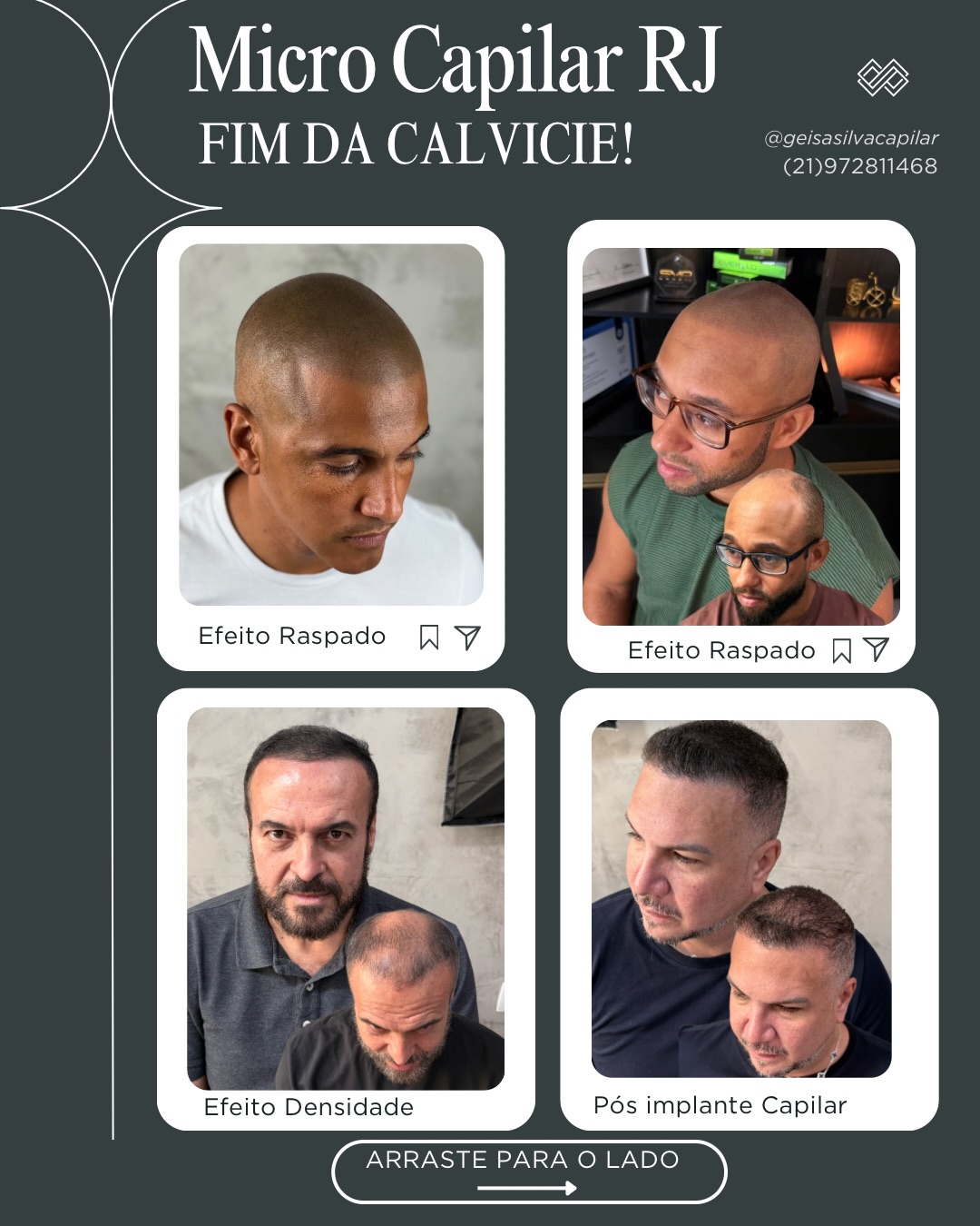 Geisa Silva - Micropigmentação Capilar Facebook ad: Diga adeus à calvície e recupere a confiança…