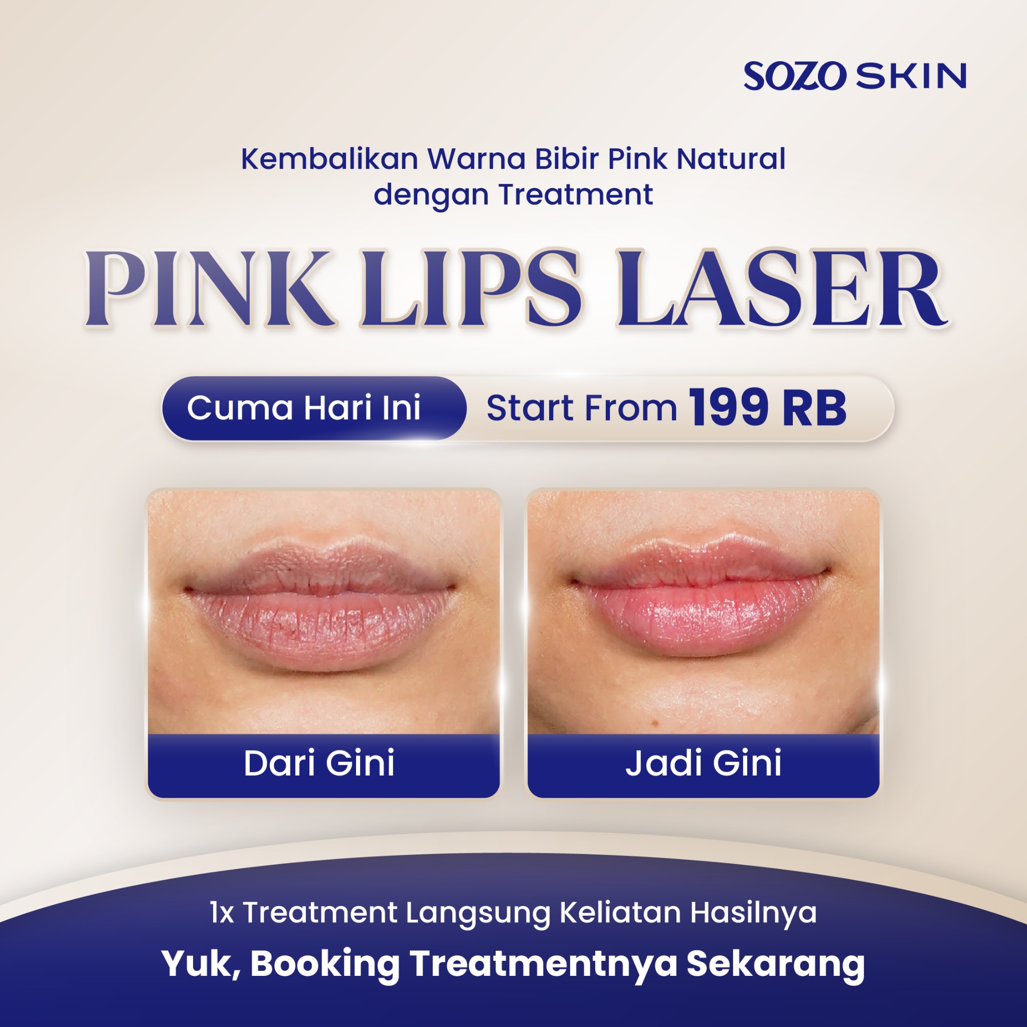 Sozo Skin Clinic Facebook ad