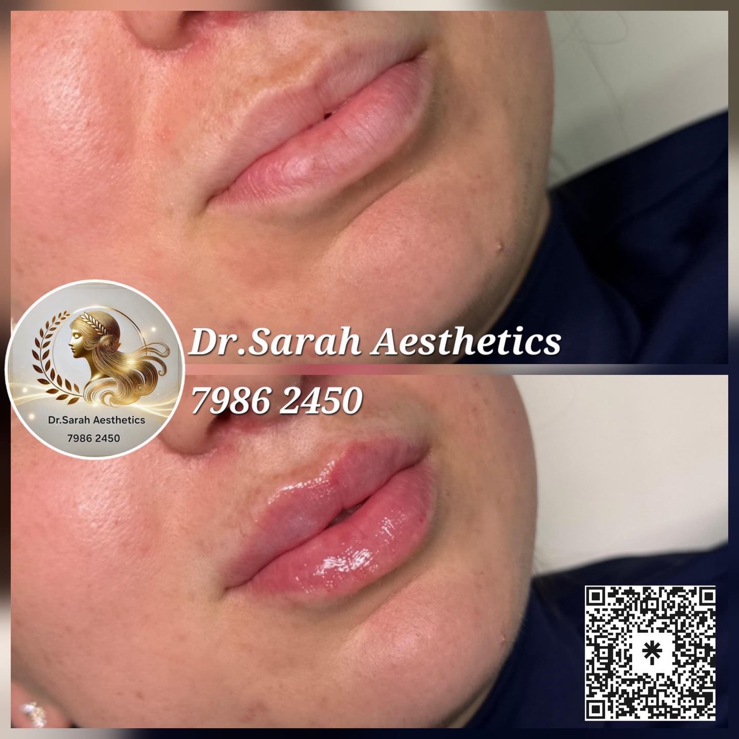Dr.Sarah Aesthetics Facebook ad: Perfect, Plump, and Natural-Looking Lips!