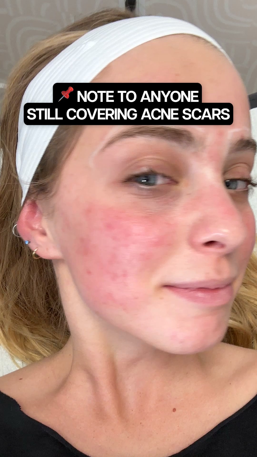 Skin Laundry Facebook ad: First Laser Facial $50 ($275 Value)