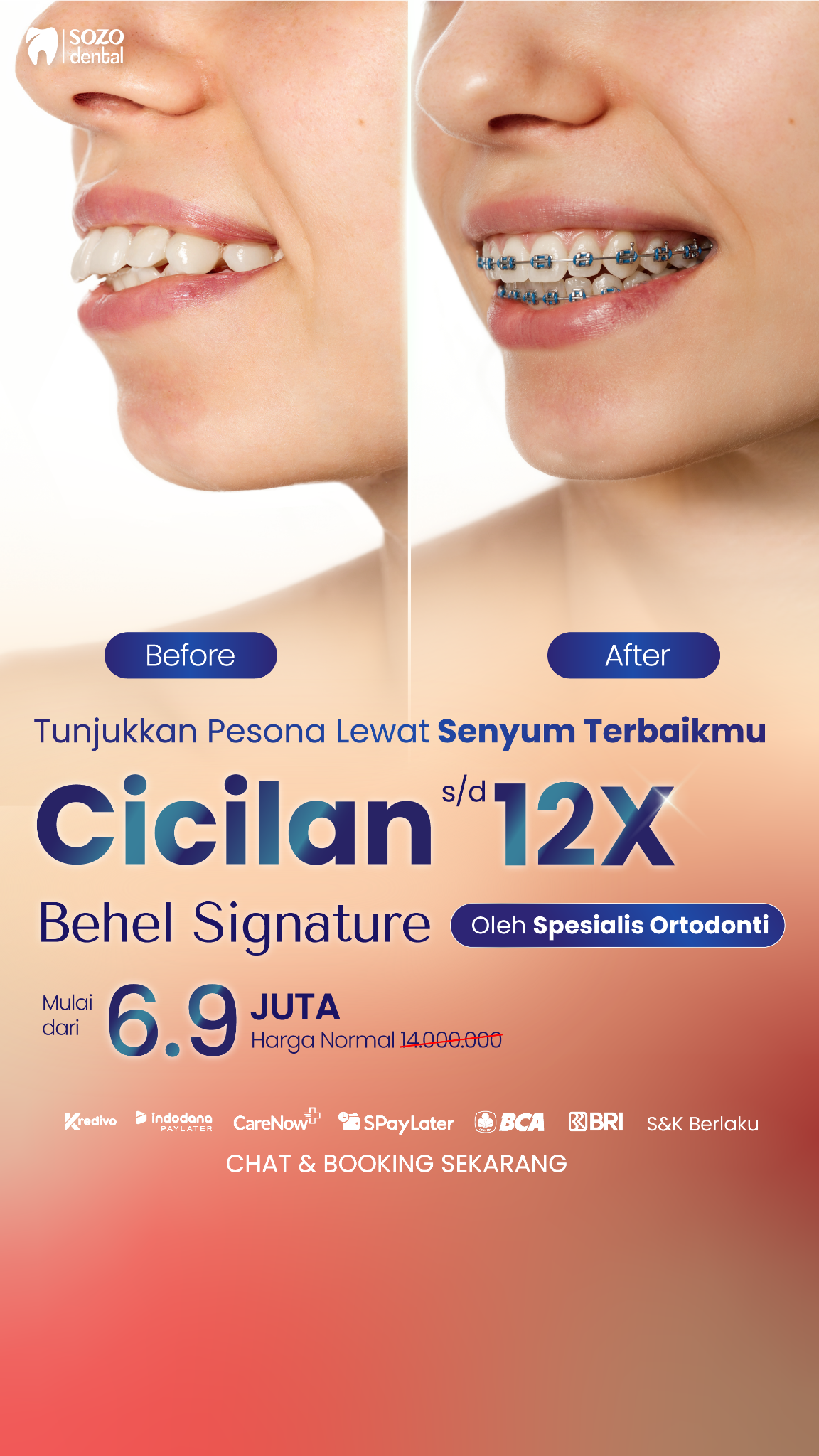 Sozo Dental Clinic Facebook ad: Behel Signature oleh Spesialis