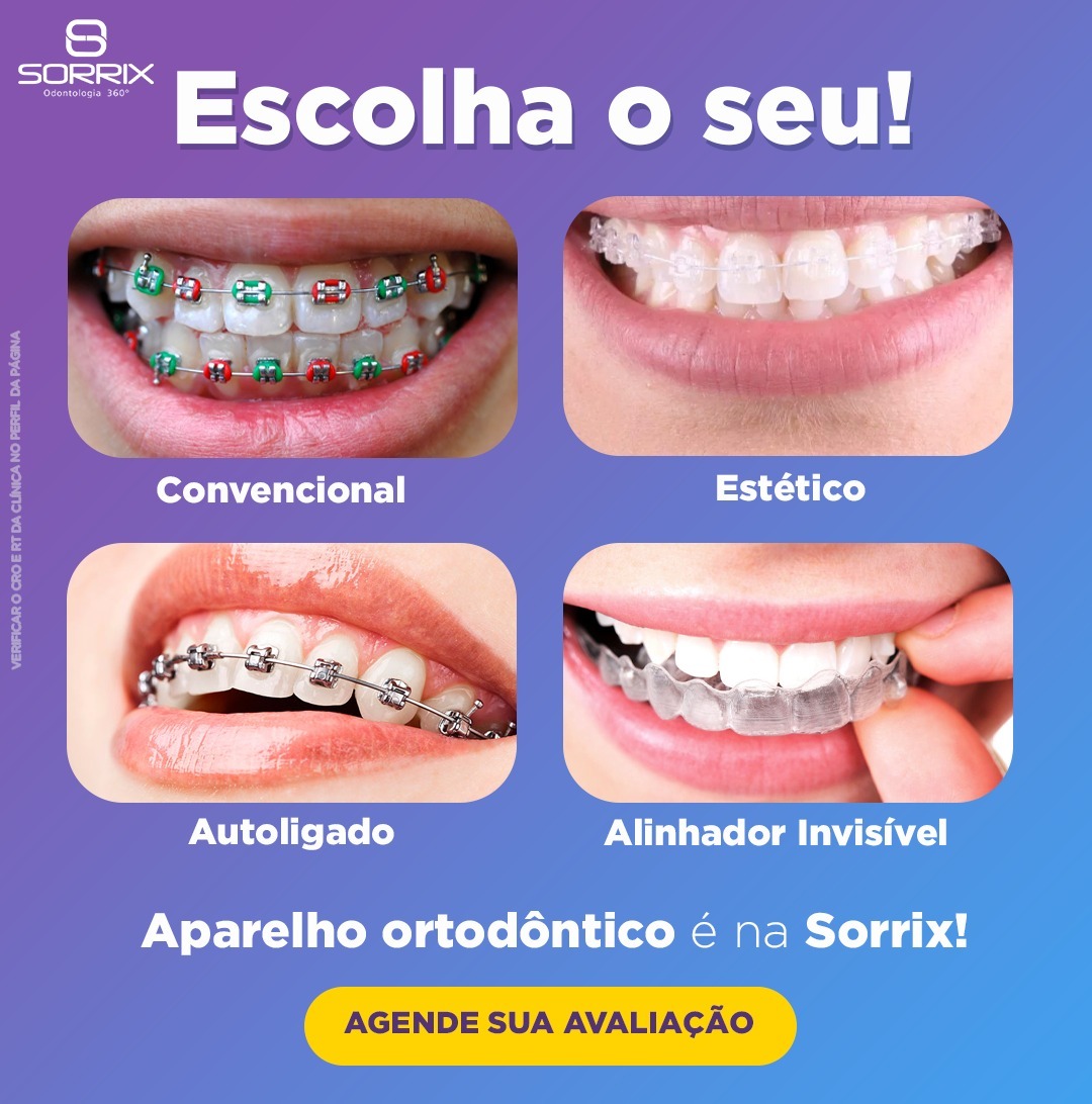 Sorrix Andrômeda Facebook ad