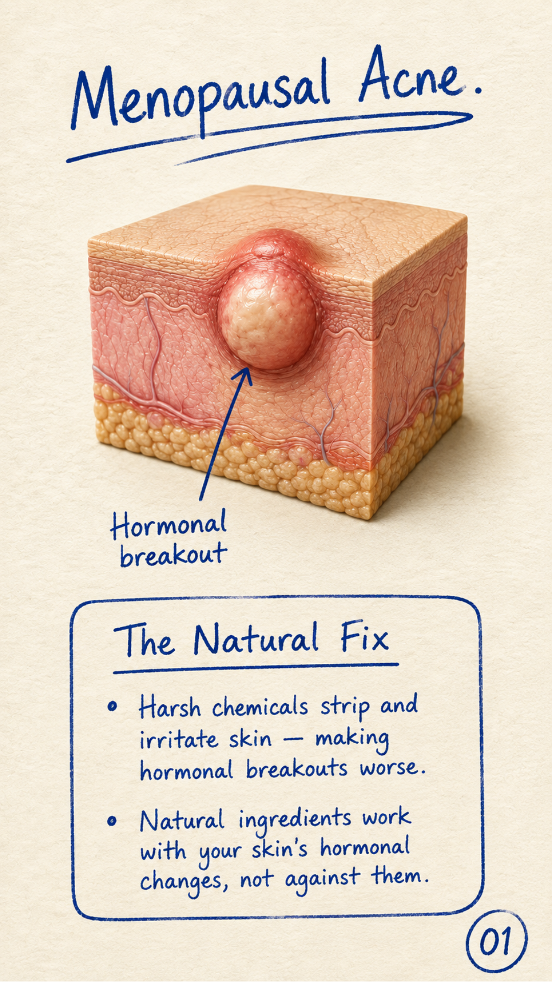 Dr. Susan Facebook ad: Hormonal Acne, Finally Calm