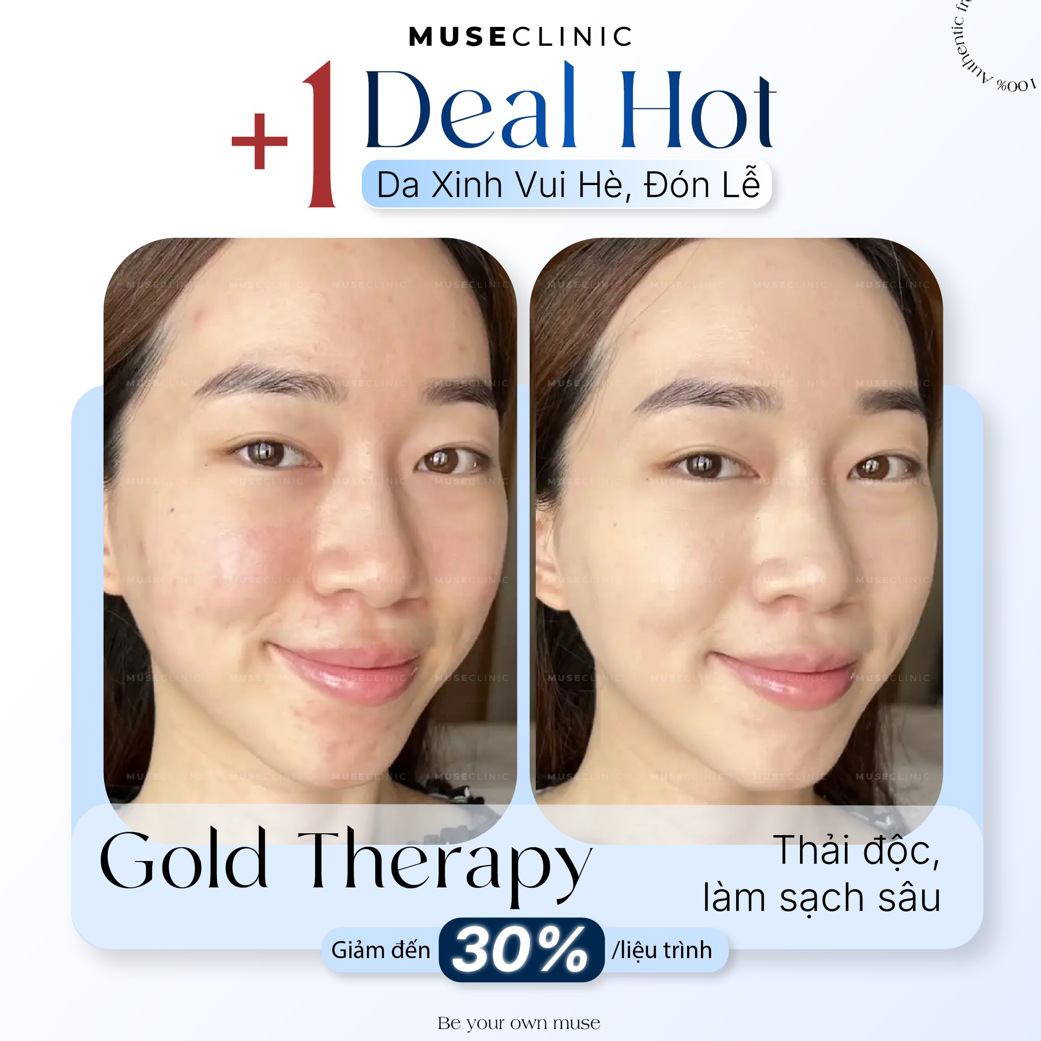 Viện da liễu Muse Clinic Facebook ad: +1 DEAL HOT | CHĂM DA XINH ĐÓN…
