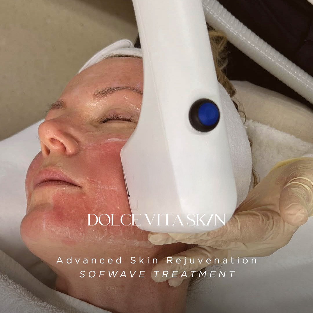 Dolce Vita Skin Facebook ad