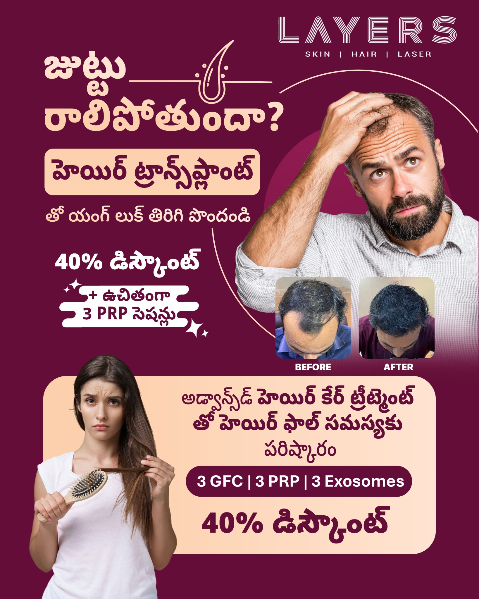 Layers Clinics Facebook ad