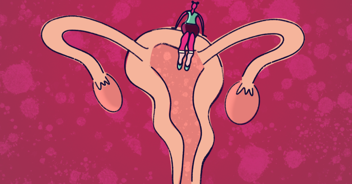 Lupus In Color Facebook ad: Is It Perimenopause Or Just My Endometriosis? |…