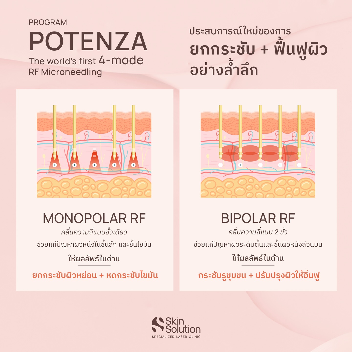 Skin Solution Clinic คลินิกเฉพาะทางผิวหนัง ความงาม และเลเซอร์ พญ.กุลวดี Facebook ad: จะดีกว่าไหม ถ้ายกกระชับผิวทั้งทีได้มากกว่าแค่การยกกระชับ…