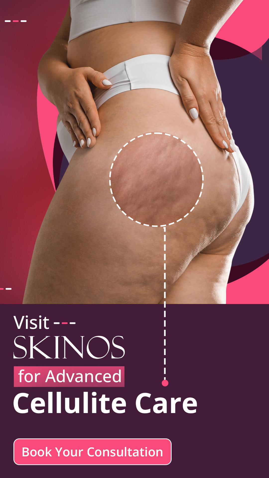 SKINOS Facebook ad
