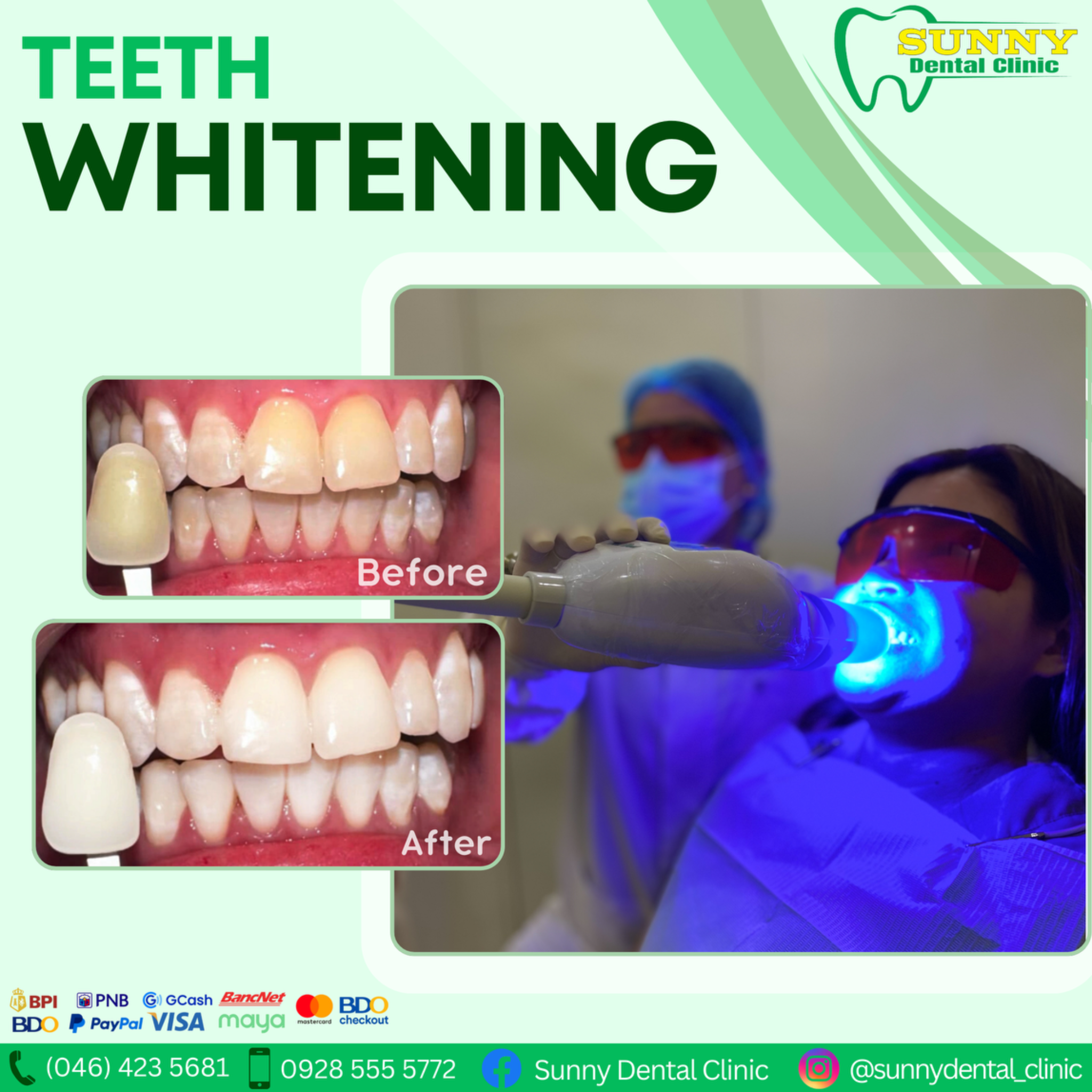 Sunny Dental Clinic Facebook ad