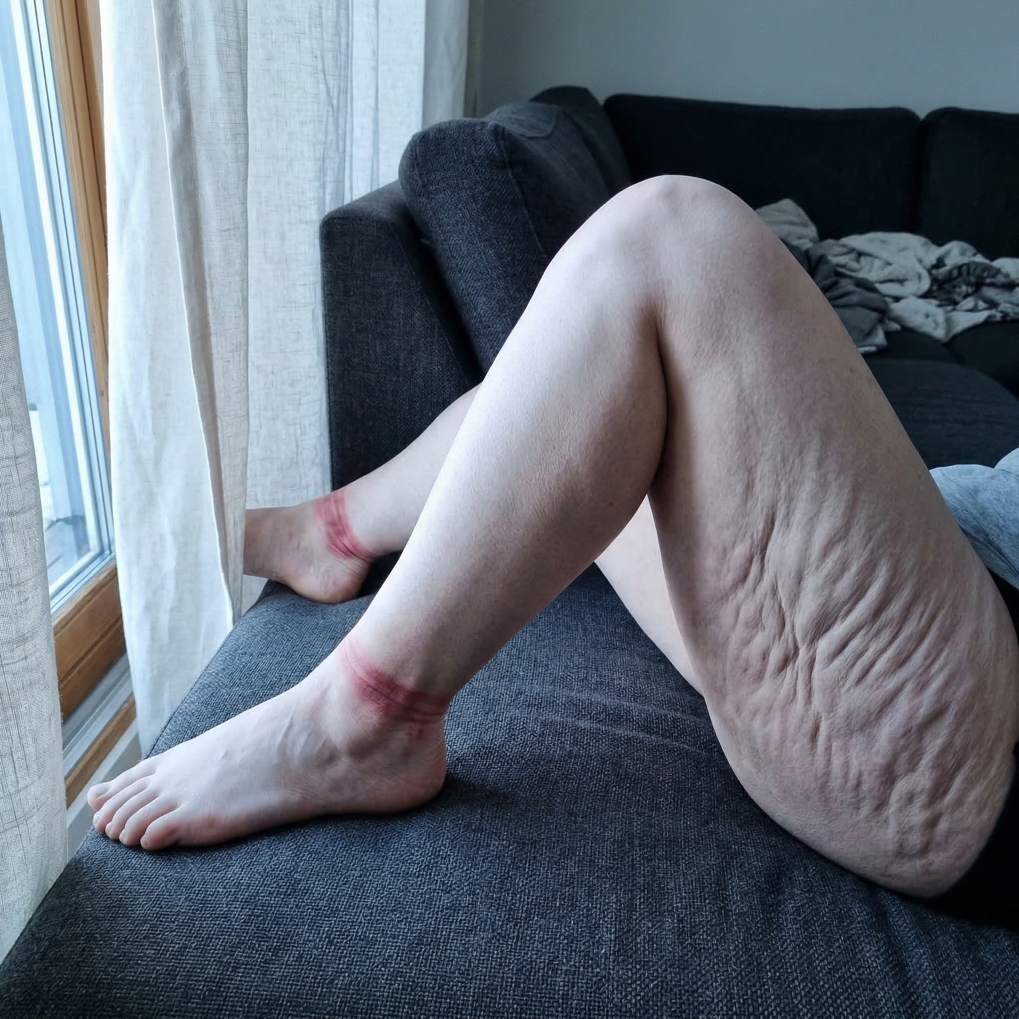 Susan Miller Facebook ad: I've Been Hiding My Legs For 3 Years.