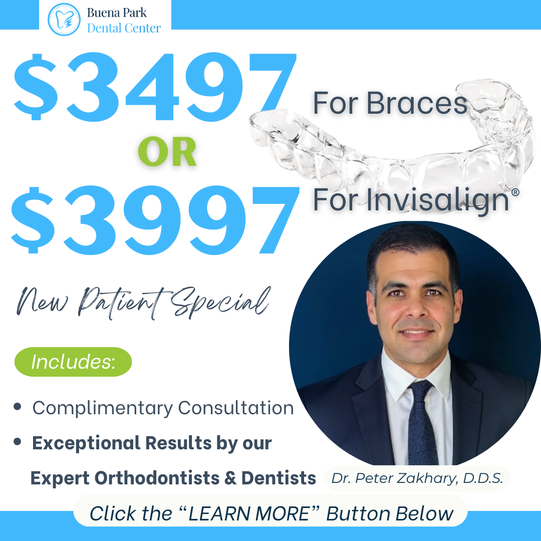 Buena Park Dental Center Facebook ad: $3497 TOTAL for Braces Treatment or $3997 TOTAL for…