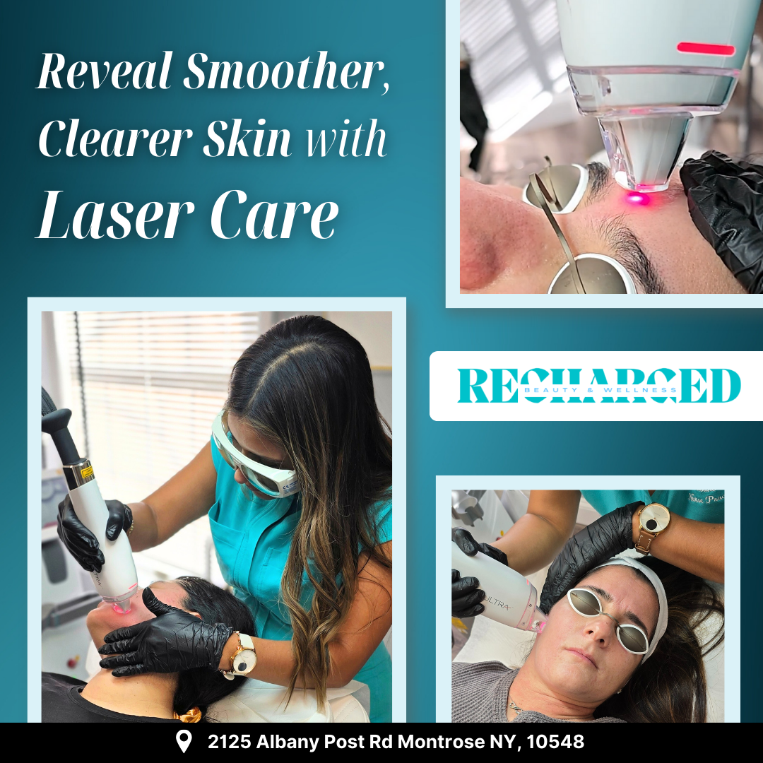 Recharged Beauty & Wellness Facebook ad: Top-Ranked Laser Aesthetics in Montrose!
