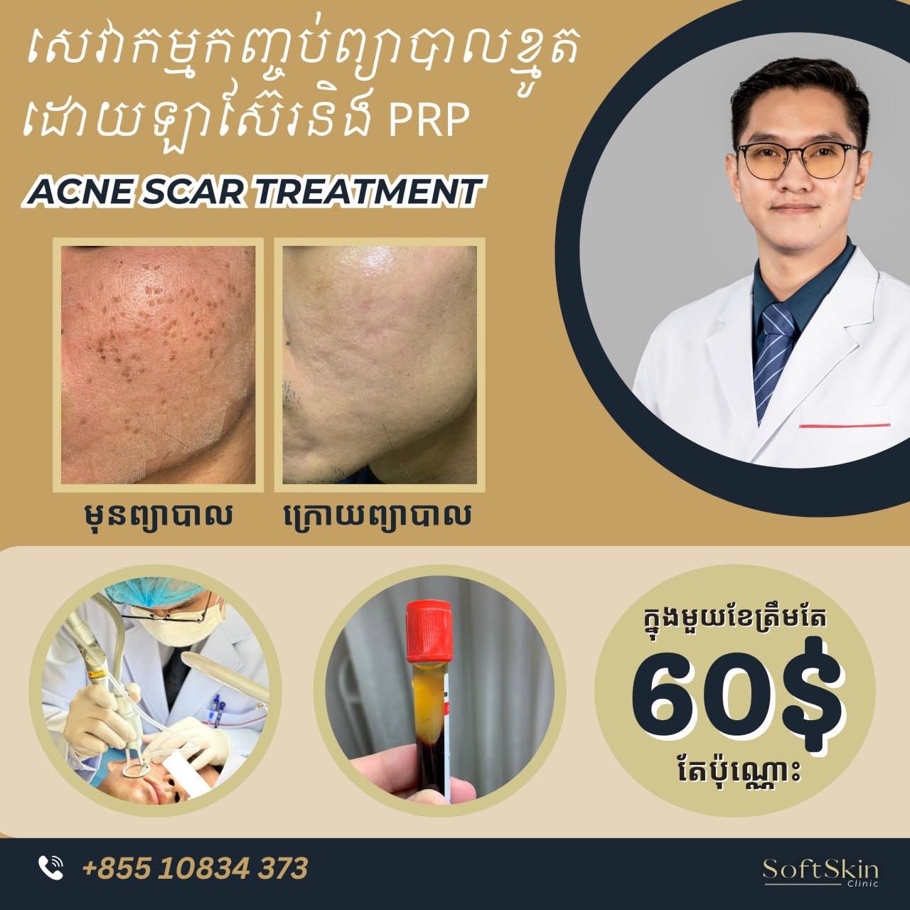 SoftSkin Clinic Facebook ad: សេវាកម្ម Laser Co2+PRP ជាវិធីសាស្ត្រព្យាបាលលើបញ្ហាស្នាមខ្មូ…