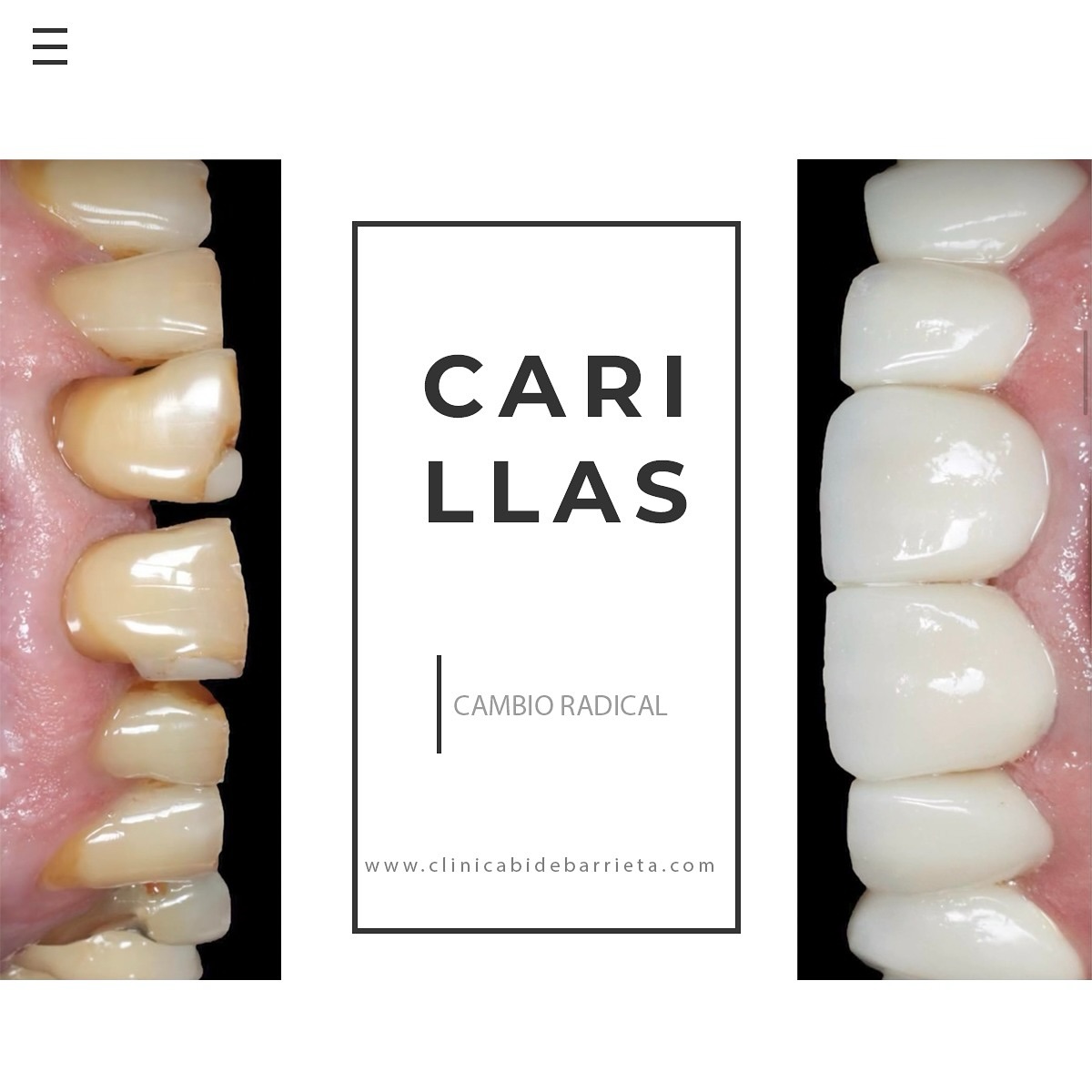 dental_bidebarrieta_ Facebook ad: Elige el color para tus dientes con las…