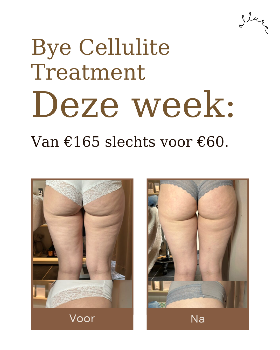 Allure Skin & Body Facebook ad: Alleen deze week