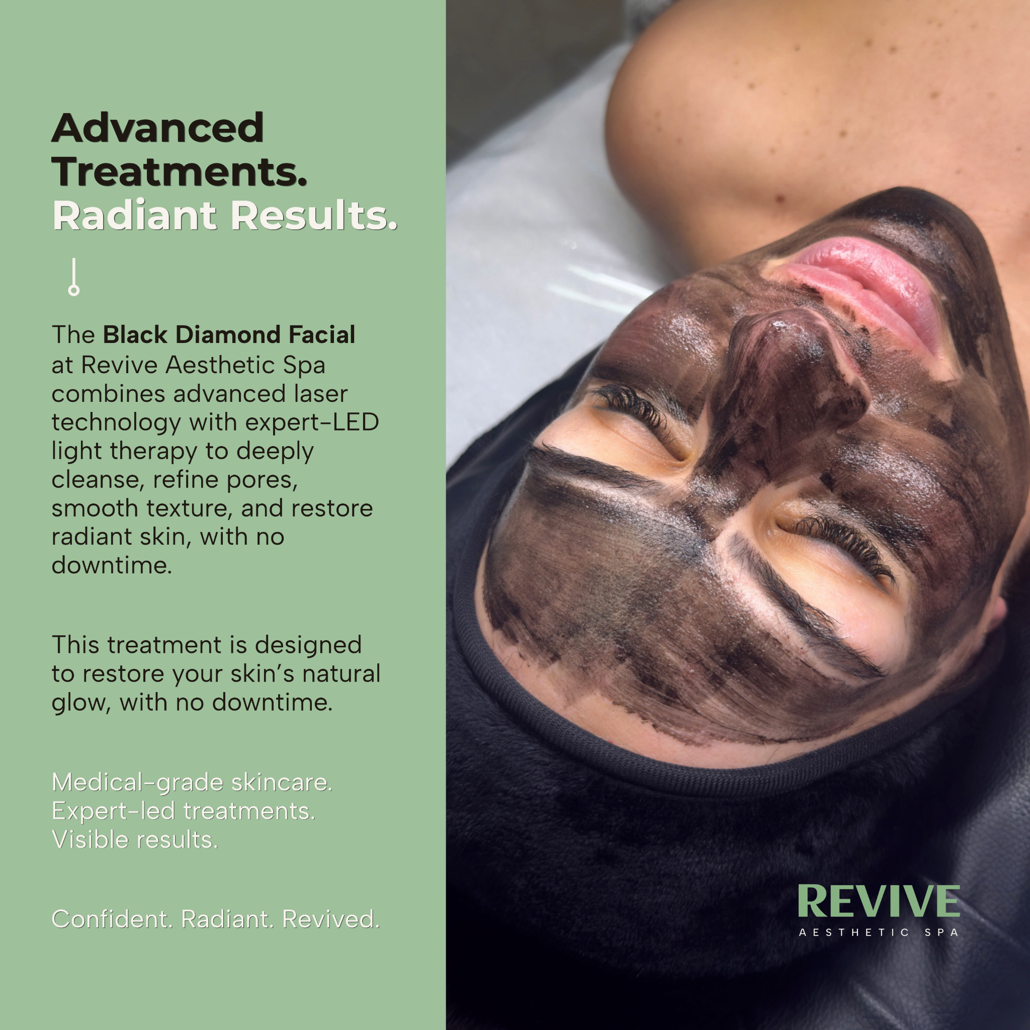 Revive Aesthetic Spa Facebook ad: The Black Diamond Facial. One Session. Real Results.