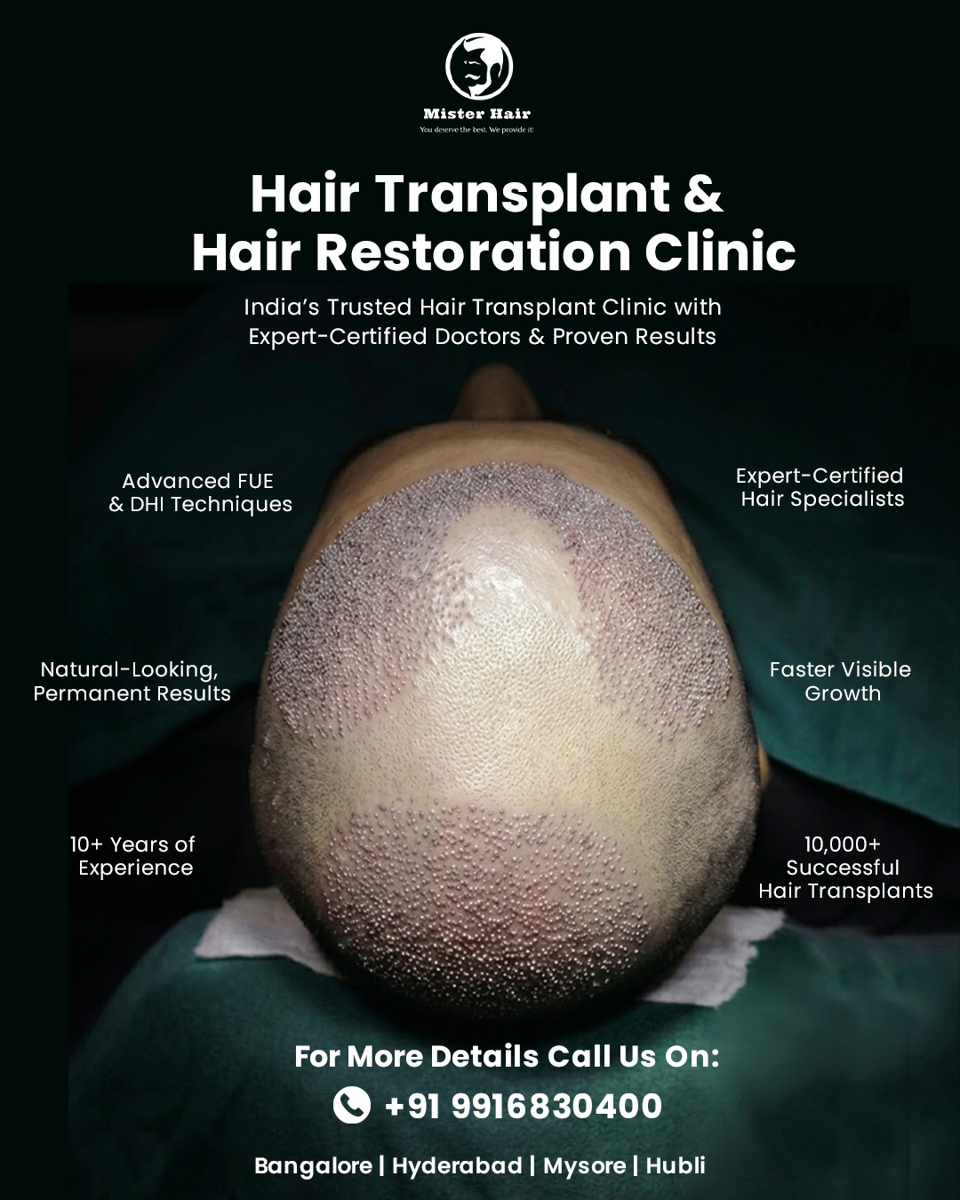 Mister Hair Clinic Facebook ad: Thinking about a Hair Transplant?