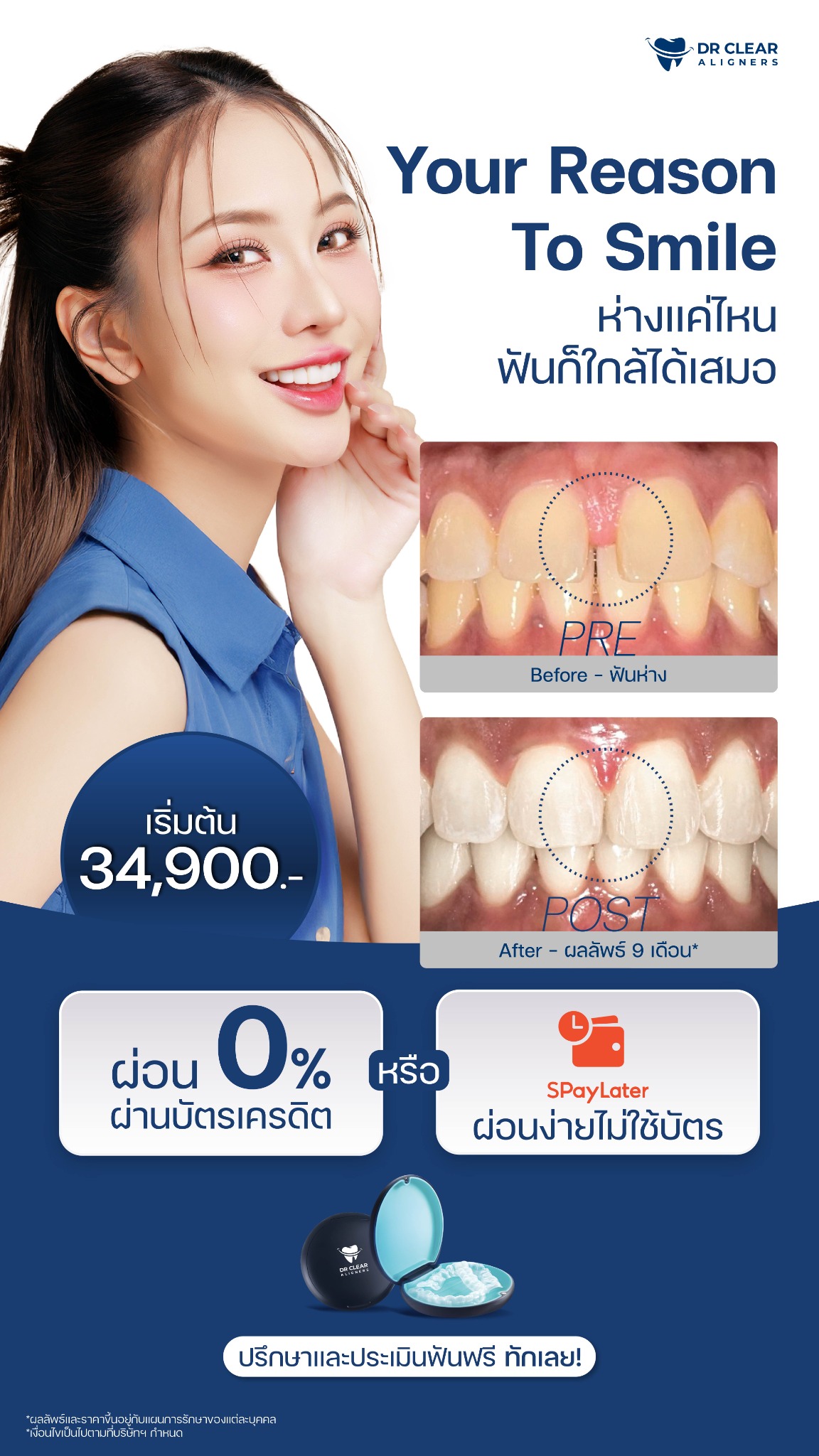 Dr Clear Aligners Thailand Facebook ad